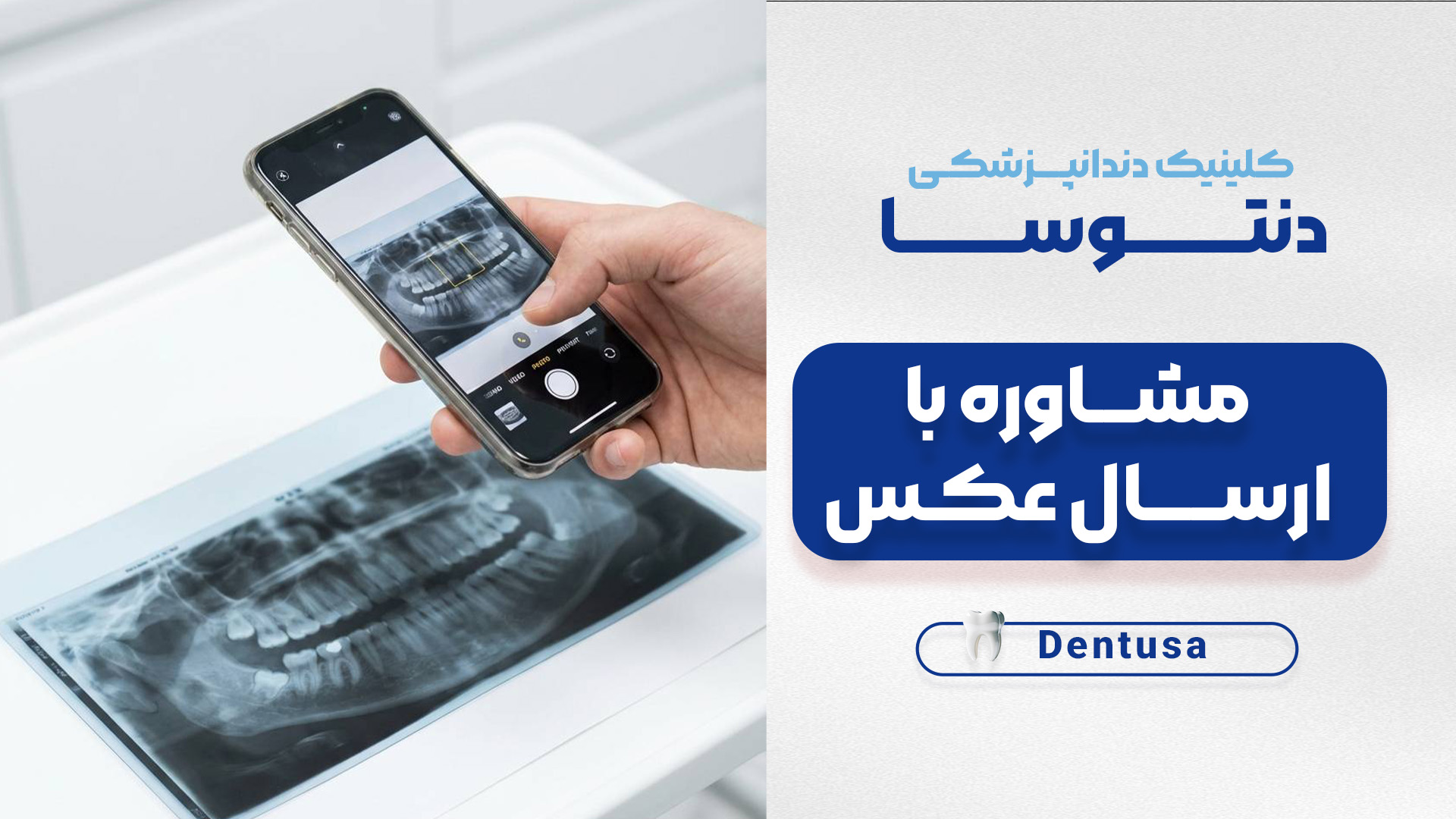 پروتز دندانی
