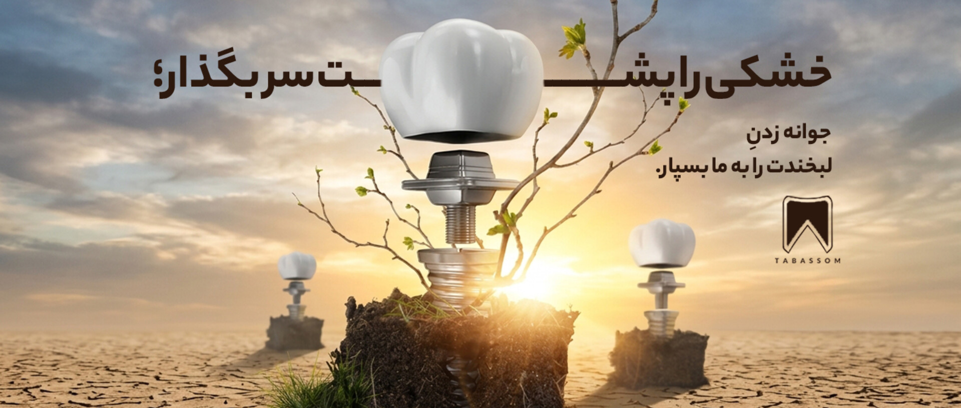 ایمپلنت